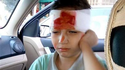 بالصور..مديرية الجيل الجديد بالإسماعيلية.. تركت تلميذ مصاب ينزف ساعتين..أولياء الامور : المدرسة 