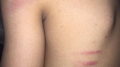 اعتداء وحشى من مدرس على طالب بدمياط