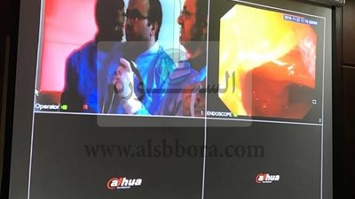 معهد الكبد القومى بالمنوفية ينظم ورشة العمل الثالثة لمناظير الأمعاء الدقيقة 