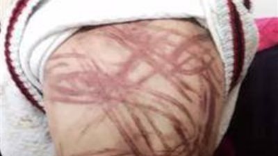 ام تعذب ابنها بـ