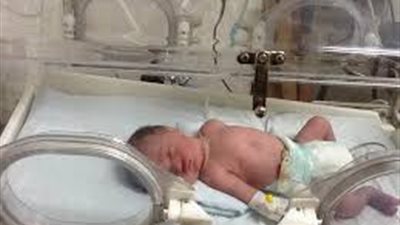 احتراق رضيعة داخل مستشفى خاص ببنى سويف