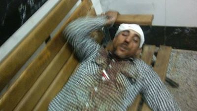 بالصور.. رجال أمن تعليم سوهاج يهشمون رأس مدرس الحاسب الآلى.. لهذه الأسباب